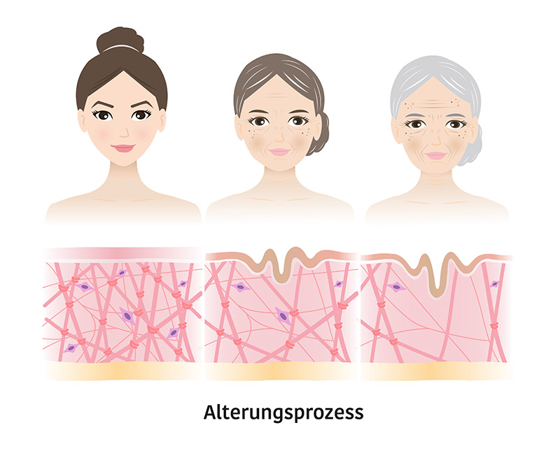 Alterungsprozess Augenklinik Sulzbach Alterungsprozess Augenklinik Sulzbach