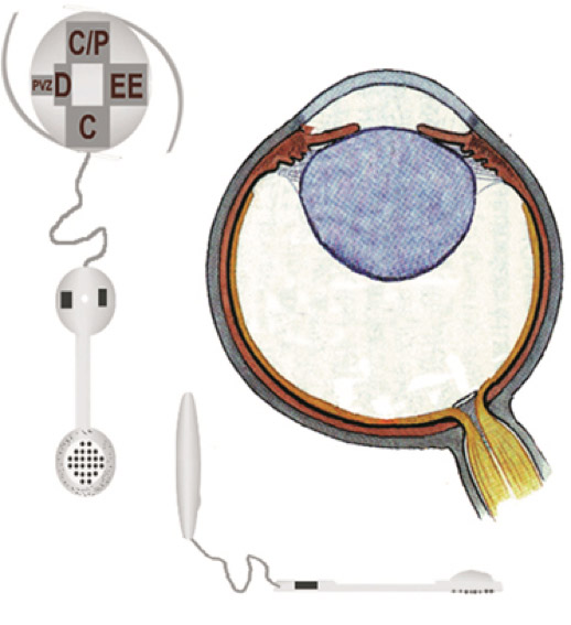 Erste Retina-Implantate